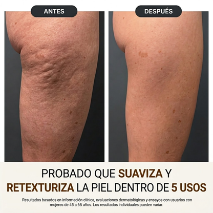 Redescubre la confianza con una piel más firme, suave y radiante