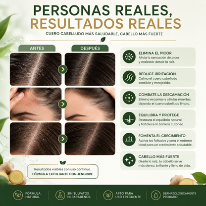 NOVAPURE EXFOLIANTE® | DESPÍDETE DE LAS ESCAMAS, LA CASPA Y EL CUERO CABELLUDO IRRITADO