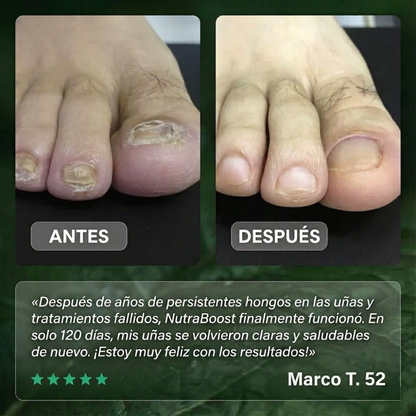 Aceite Novapure. Resultados en tan solo 7-10 dias.