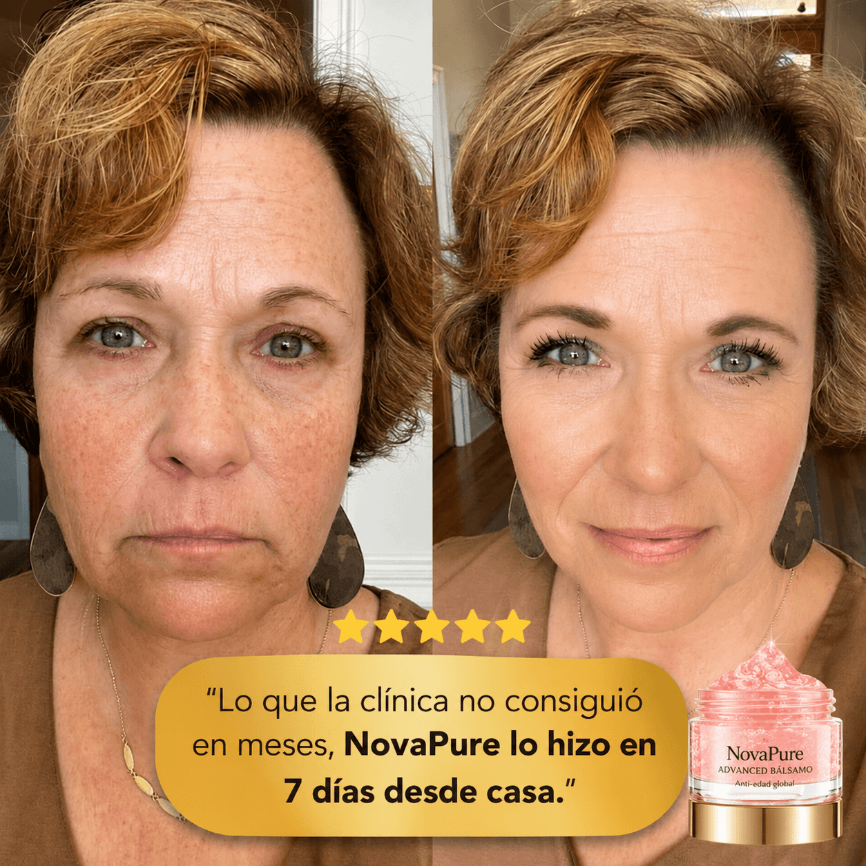 Bálsamo NovaPure® |Elimina Arrugas y Rejuvenece Tu Piel